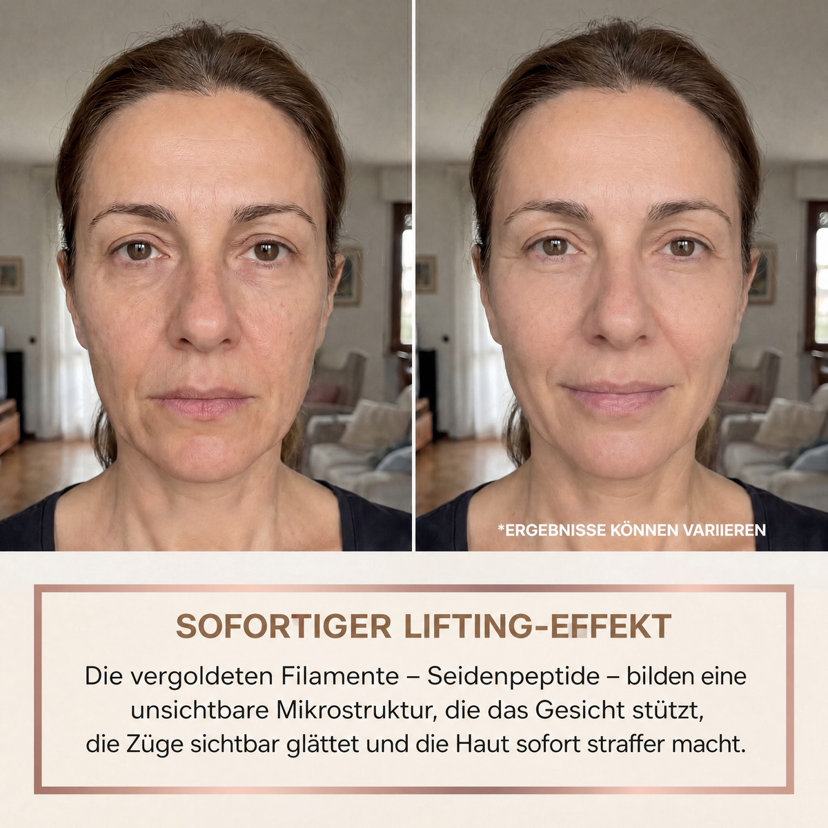 Galerie produit · image 2 (avant / après effet lifting)