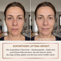 Galerie produit · image 2 (avant / après effet lifting)