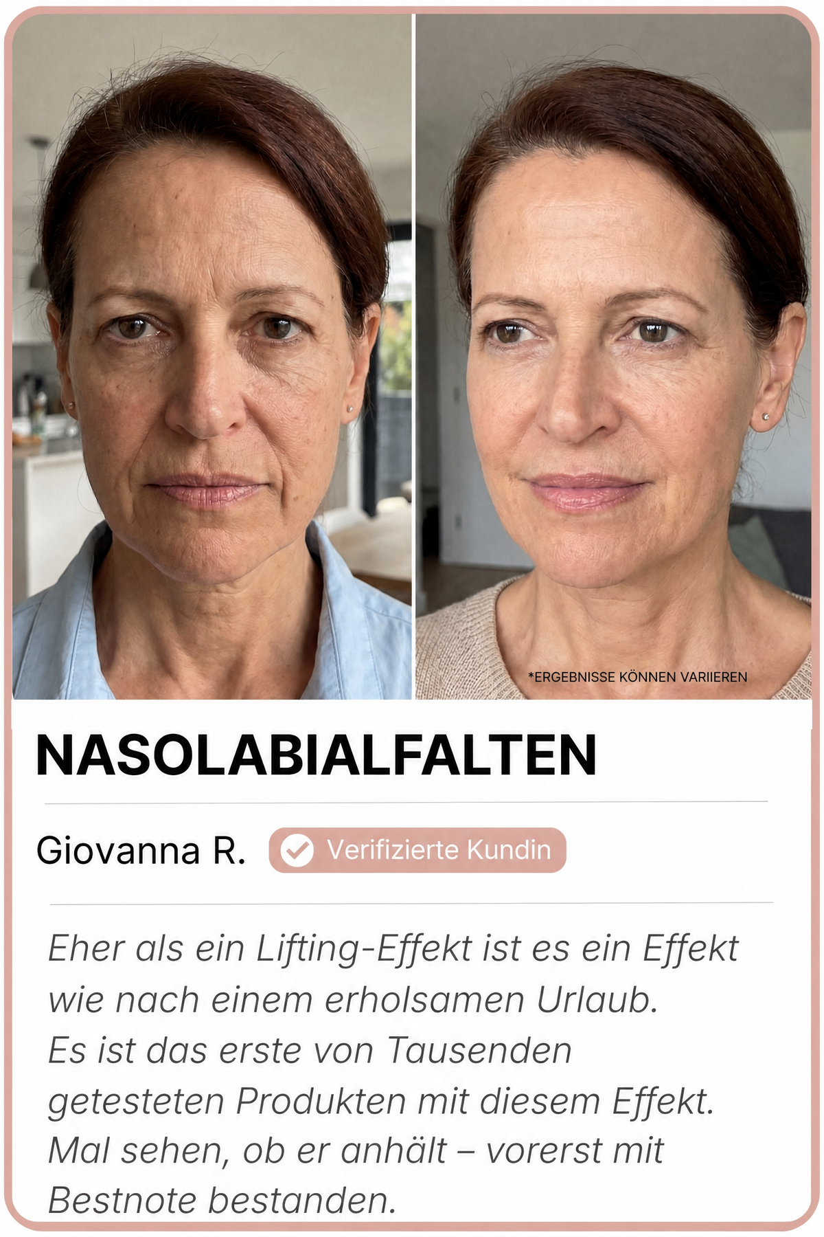 Siero · avant / après — image 1