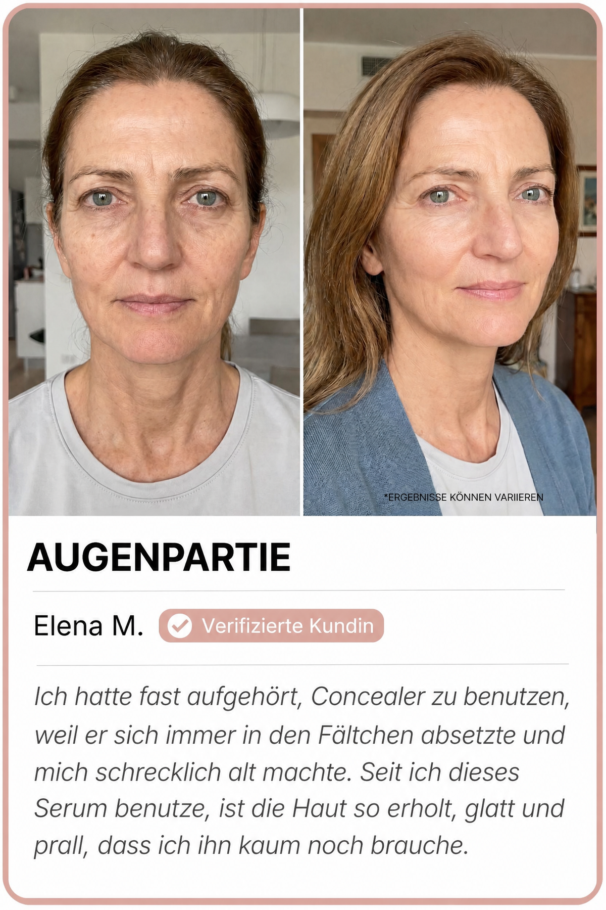 Siero · avant / après — image 2